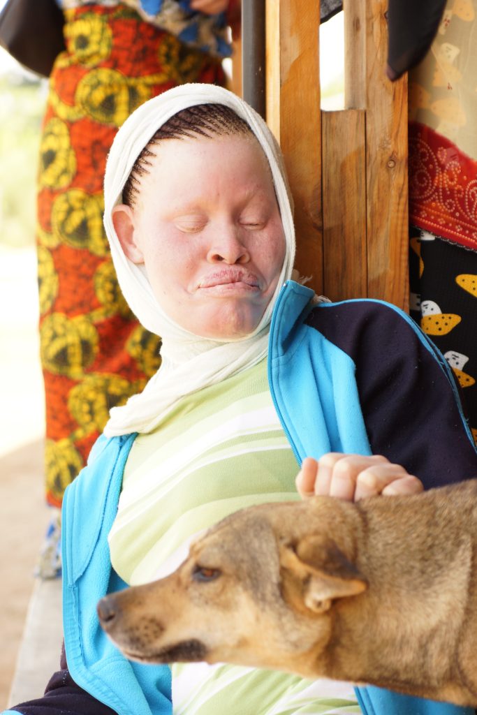 Tanzania Albinism Collective Release New Single In Celebration of International Albinism Awareness Day